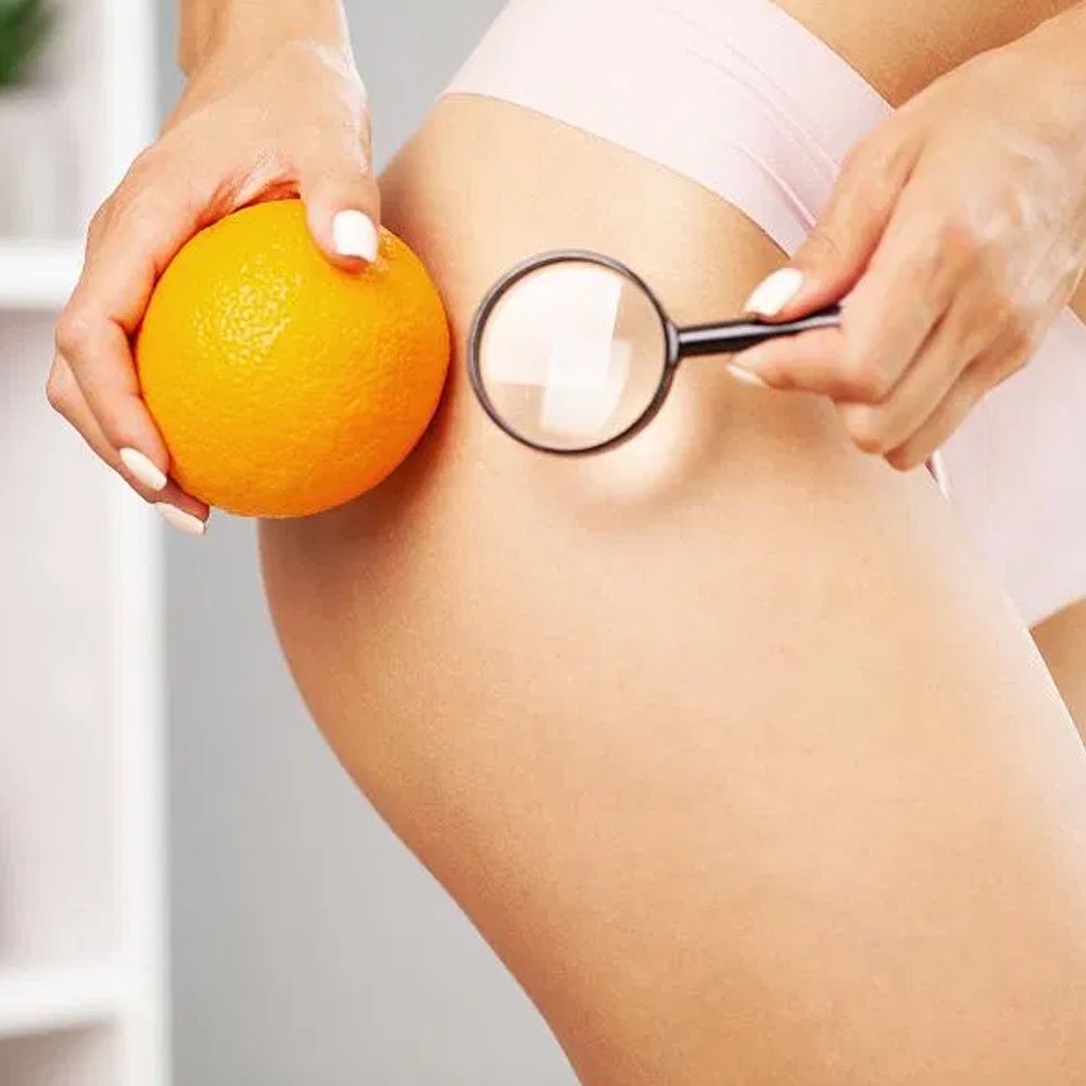 eliminacion celulitis